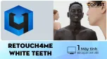 Retouch4me White Teeth bản quyền